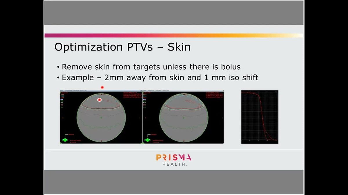 Eclipse NTO Parameters Offer Precise Dose Fall-Off Control