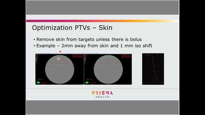 Eclipse NTO Parameters Offer Precise Dose Fall-Off Control