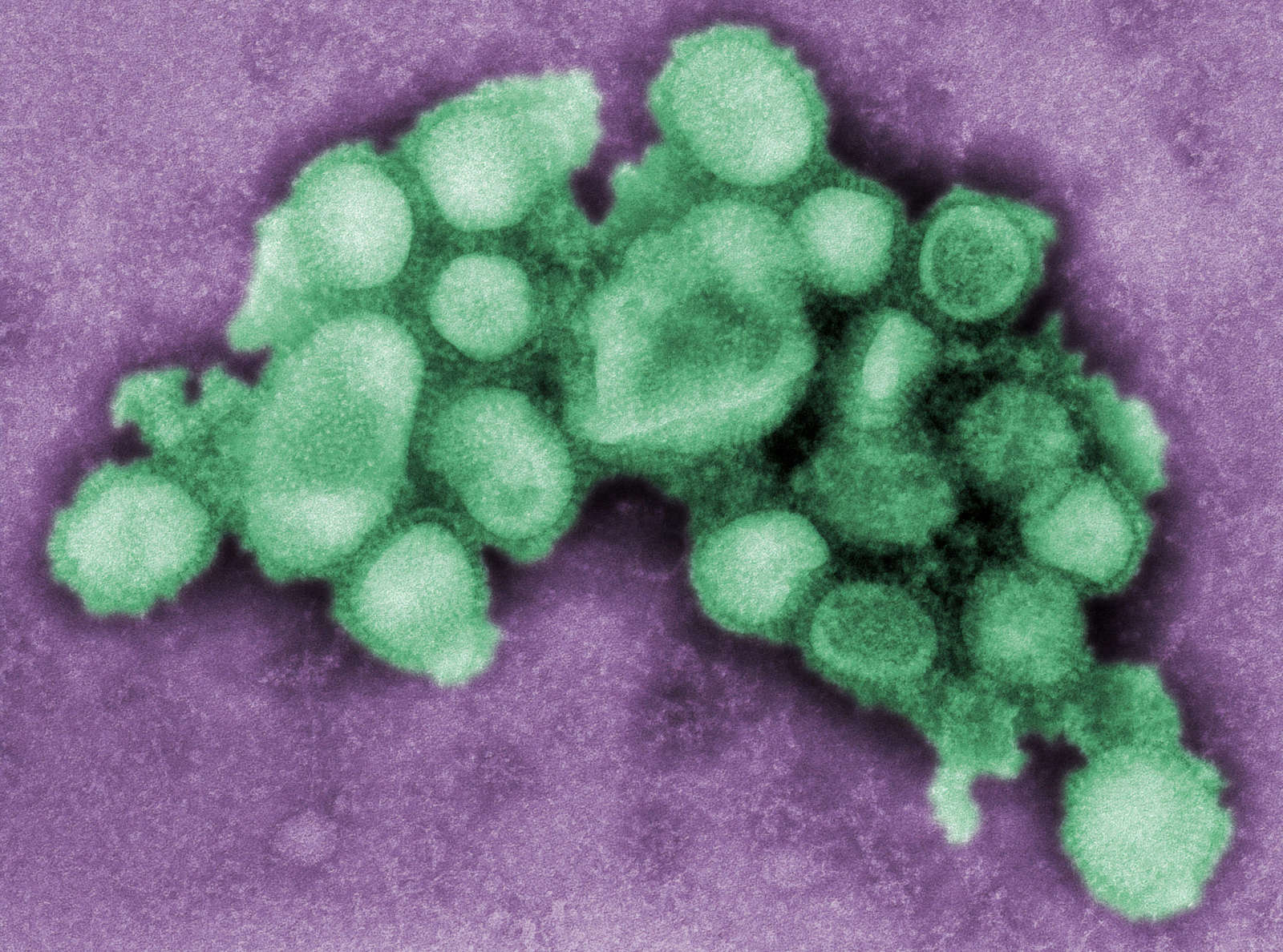 A/CA/4/09 Swine Flu virus