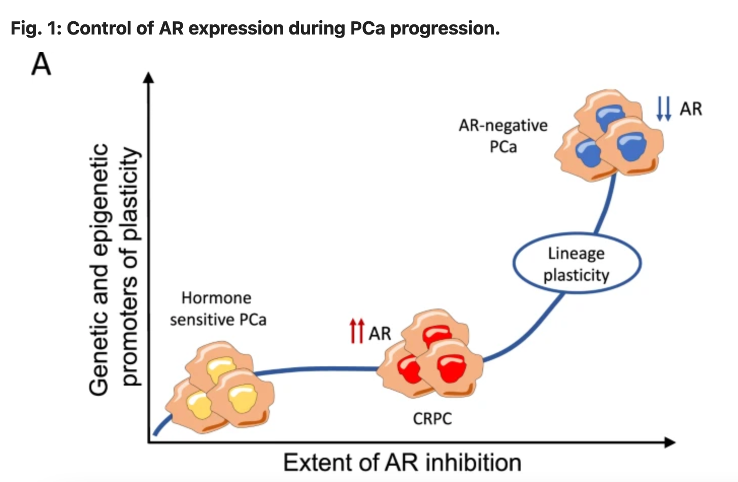 Prostate cancer’s relationship with testosterone changes once it becomes castration-resistant. PCa= Prostate Cancer AR= androgen receptor (where testosterone lands to change cell behavior) CRPC= castration-resistant prostate cancer. Source: Formaggio N, et al.Oncogene. 2021;40: 1205-1216. https://www.nature.com/articles/s41388-020-01598-0