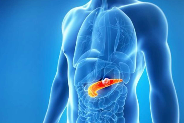 Three-way approach for precision strike against pancreatic cancer