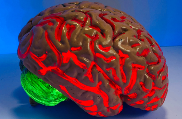 COVID-19 FAQ: What are the long-term health effects of COVID-19 on the brain?