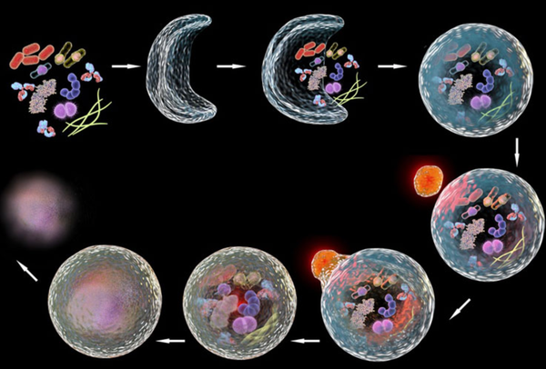 Can self-eating be the elixir of life?