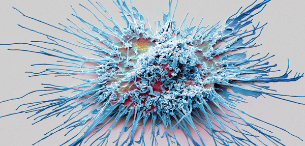Immunity Vs. Cancer: the "intelligence agents" of our immune system join the immunotherapy task force