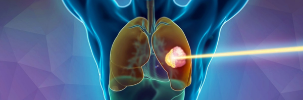 Up Next: Treating Cancer in a FLASH