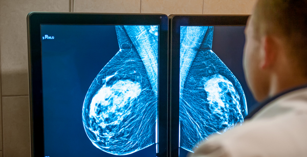 Cancer Overdiagnosis - Sending You to Chemo When You Don’t Need It