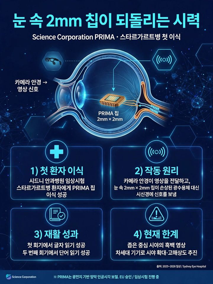 🧠 Science Corporation implants its vision-restoring chip in its first Stargardt disease patient