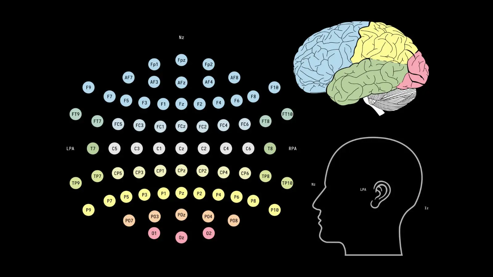 Diagram of EEG electrode placement on the scalp using the International 10–20 system, illustrating that EEG measures surface cortical activity rather than the entire brain