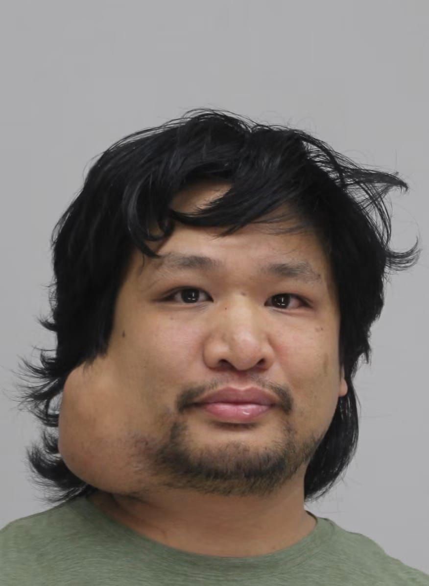 Alexander Chin | Dallas County, Texas