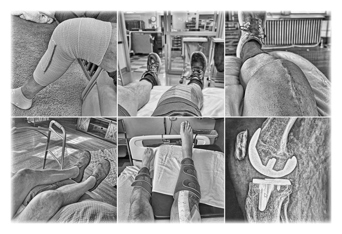 My knee in 2025