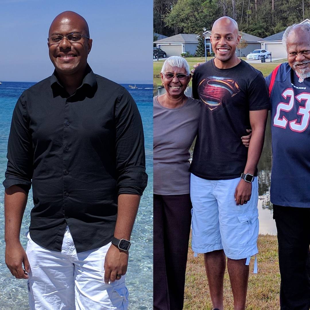 before-and-after