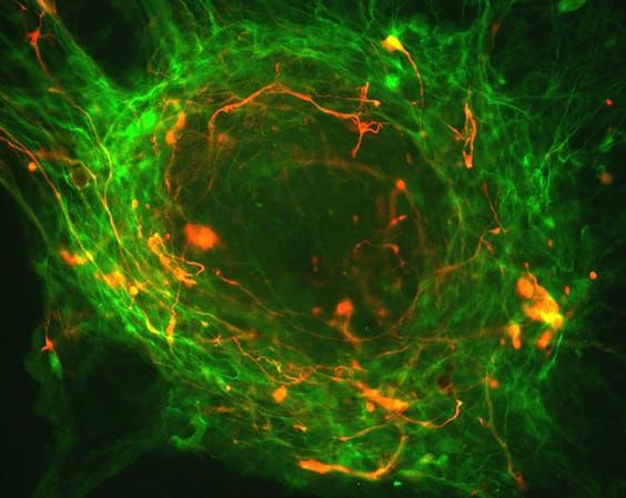 California Elections 2020: Proposition 14 - Stem Cell Research