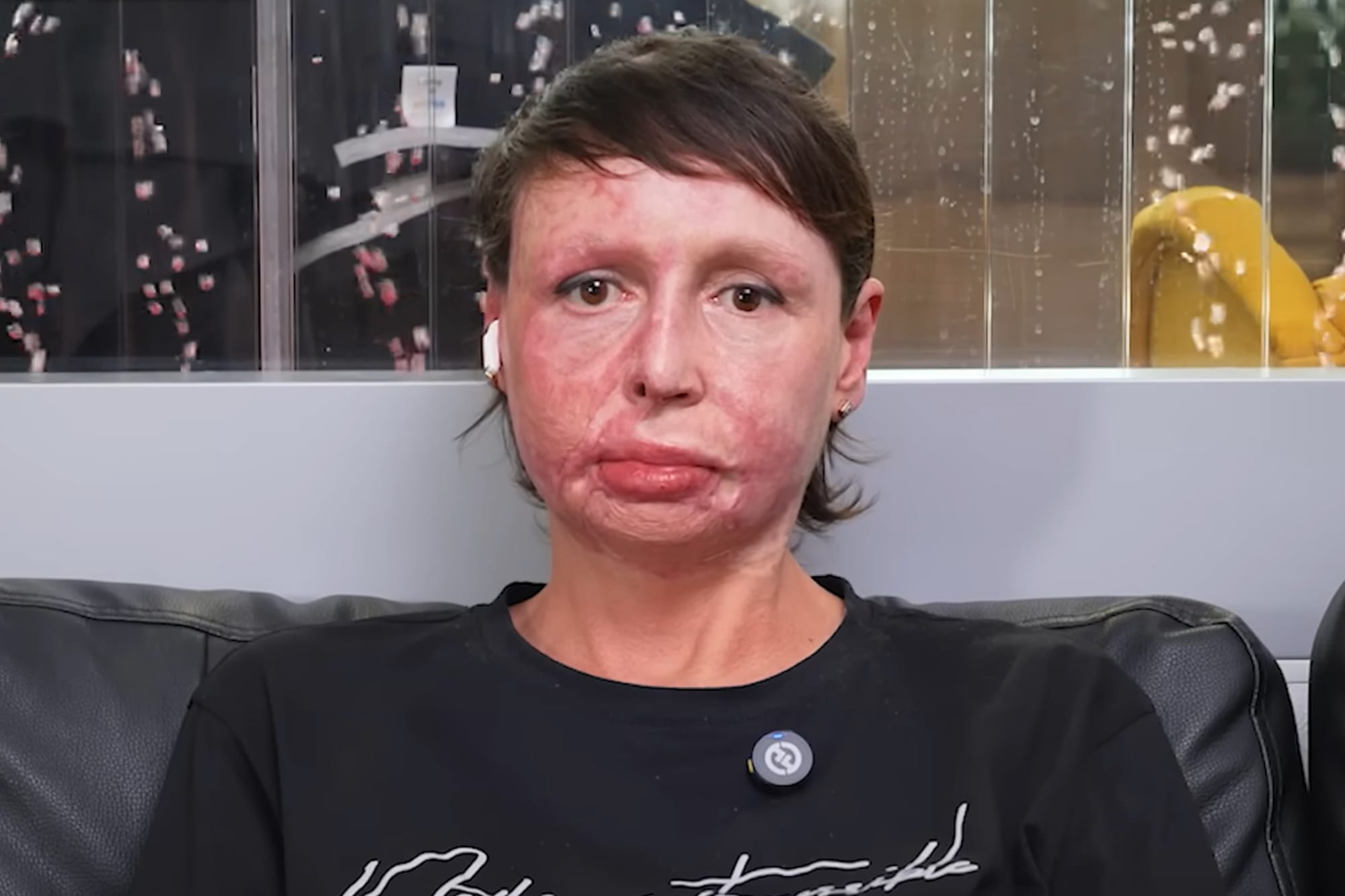 Оксана Кузьменко в августе 2024 года. В Екатеринбурге мужчина похитил и пытал бывшую девушку, а потом повез ее на кладбище. Ей чудом удалось спастись.