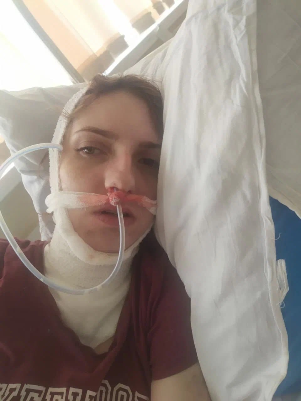 Анна в больнице после удаления зуба мудрости