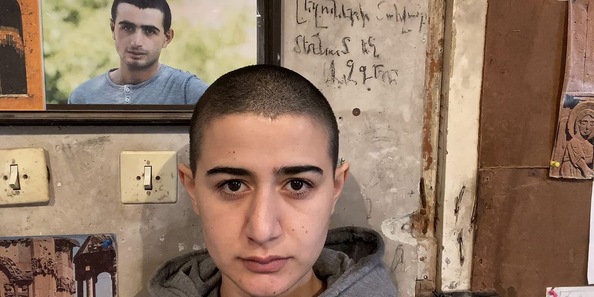 Шогакат Варданян после того, как постриглась налысо