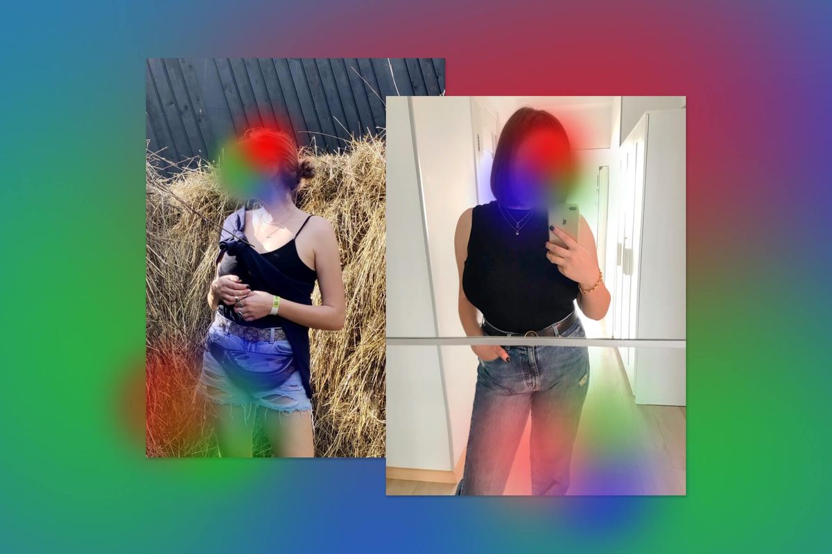 Я уменьшила грудь и счастлива