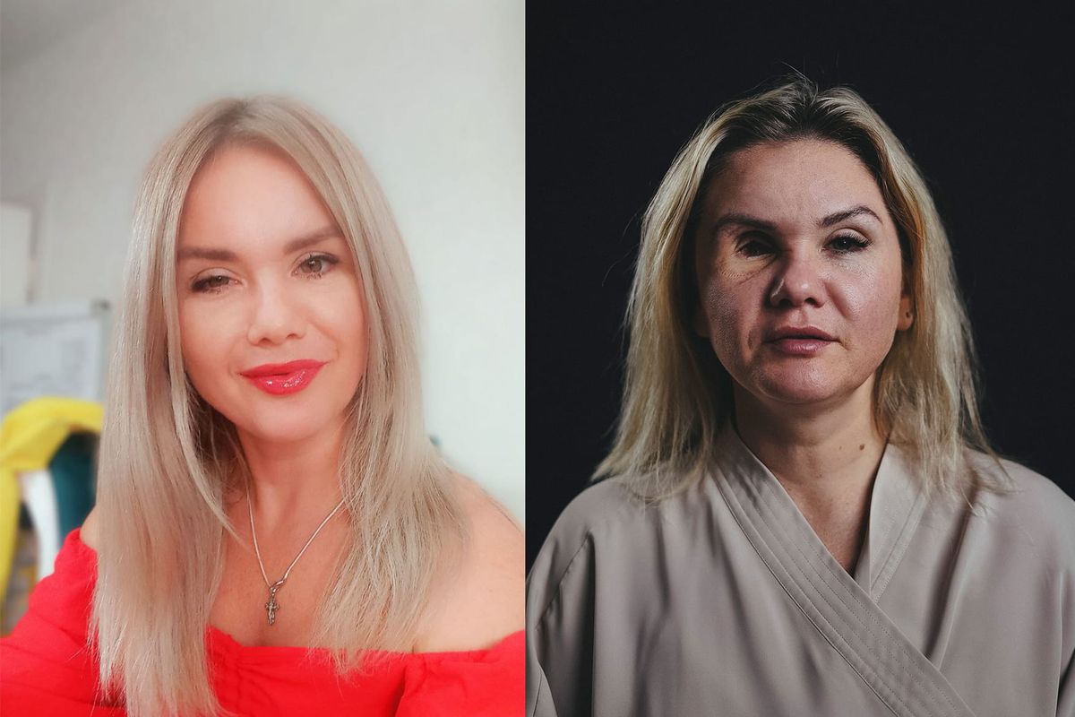 Мой бывший пробил мне череп ключом от машины