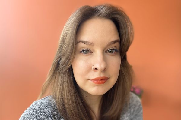 Я прожила с косоглазием почти 30 лет