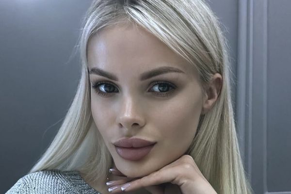 Избитая до потери памяти модель примирилась со своим партнером
