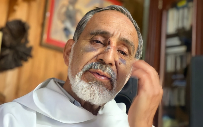 "Estamos expostos a tudo”: Sacerdote é atacado e brutalmente agredido ao voltar para casa