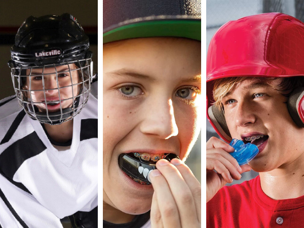 Smile Safe With Our 5 Five Picks Of Mouth Guards For Braces!