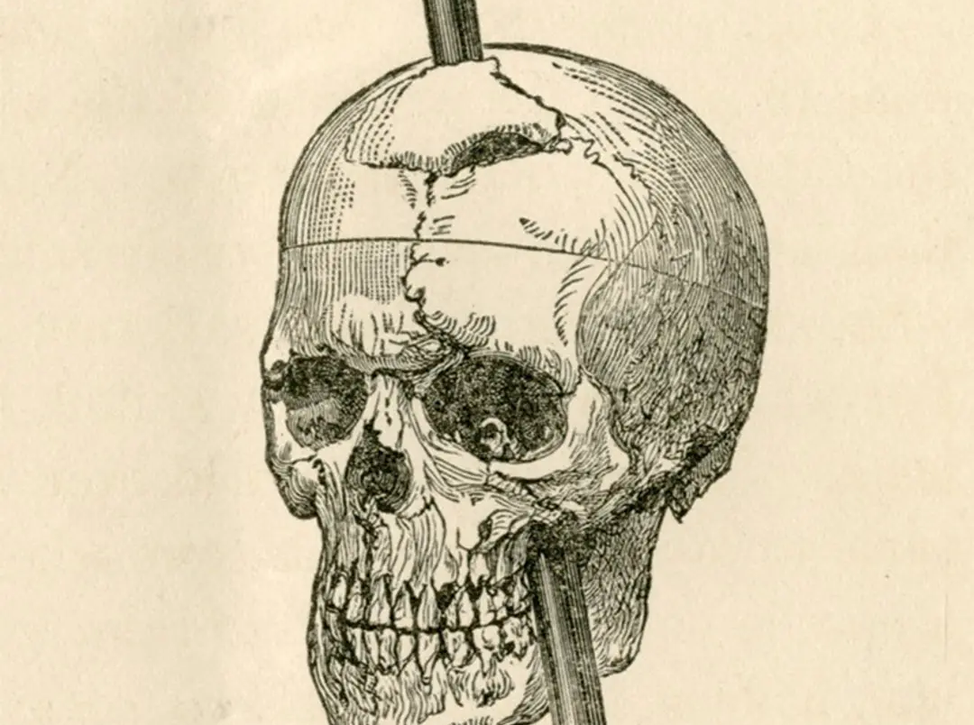 Most of what we know about a famous brain injury case is wrong