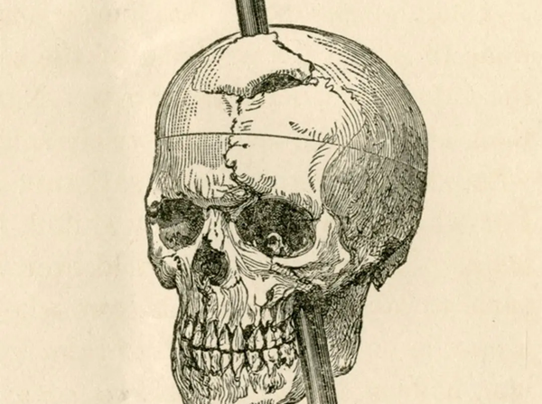 Most of what we know about a famous brain injury case is wrong