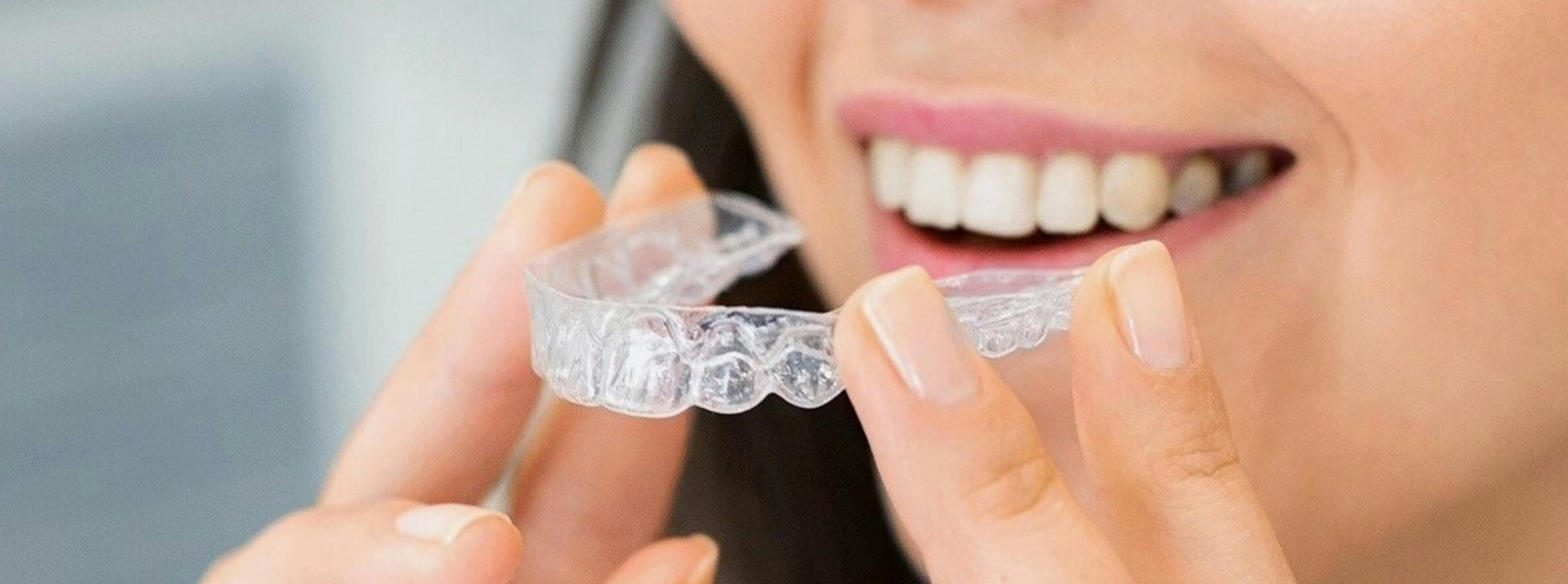 Eine Frau zieht eine Invisalign-Schiene an.