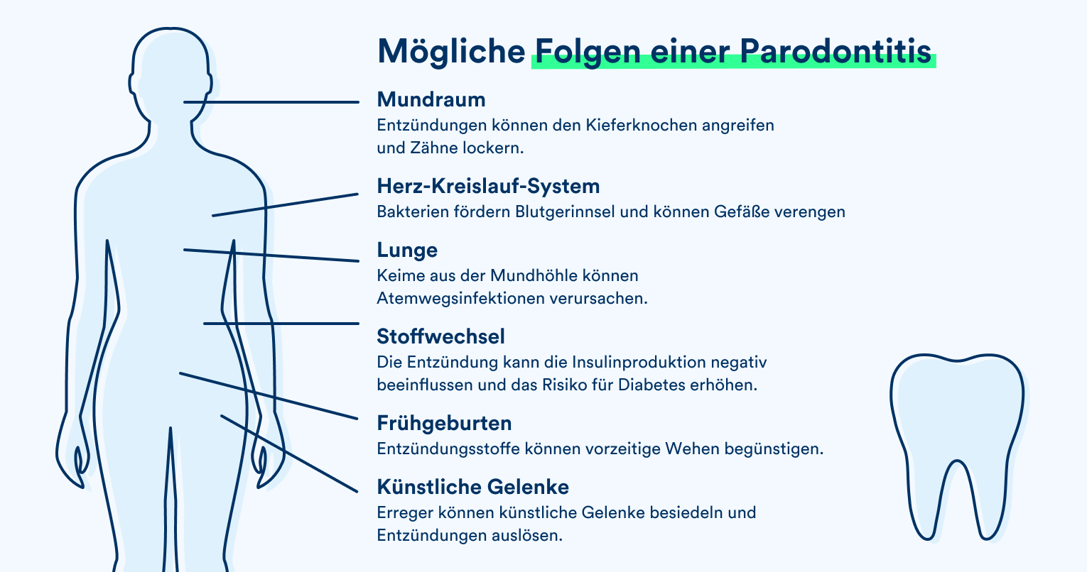 Eine Grafik zeigt die möglichen Folgen einer Parodontitis.