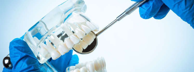 Zu sehen ist ein Schaumodell eines Gebisses mit einem Keramikimplantat.