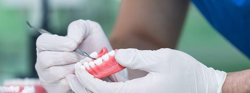 Zu sehen ist die Anfertigung einer Prothese, um zu zeigen, wie viel eine Prothese kosten kann durch den hohen Aufwand.