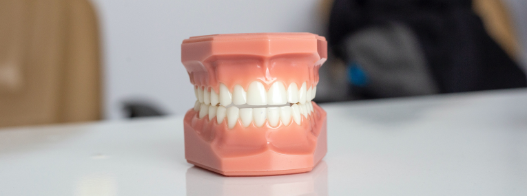 Ein Zahnmodell veranschaulicht Zähneknirschen und die Belastung der Zähne.