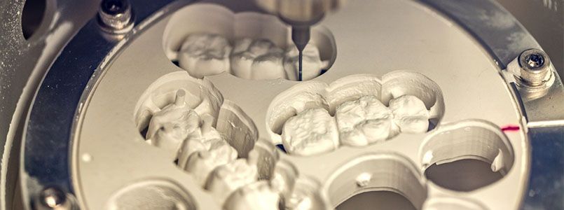Auf diesem Bild ist ein am Computer erstellter CAD CAM Zahnersatz zu sehen.