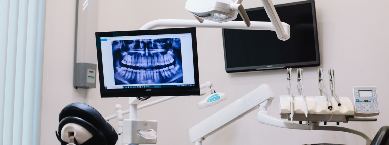 Zu sehen ist das Röntgenbild eines Patienten, der einen Kieferbruch erlitten hat.