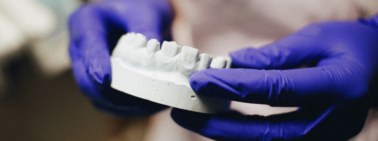 Zu sehen ist ein Zahnabdruck, der benutzt wird, um eine Teleskopkrone anzufertigen.