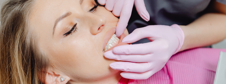 Eine Frau wird beim Zahnarzt auf Zahnfleischrückgang untersucht.