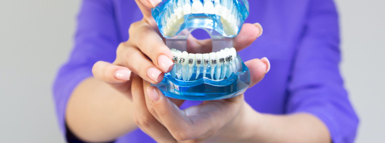 Zu sehen ist ein Schaumodell mit einer Zahnspange.