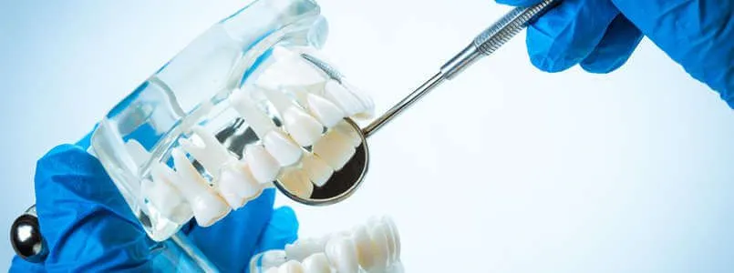 Zu sehen ist ein Schaumodell eines Gebisses, das bei der Entscheidung zwischen Implantat oder Brücke als Zahnersatz hilft.