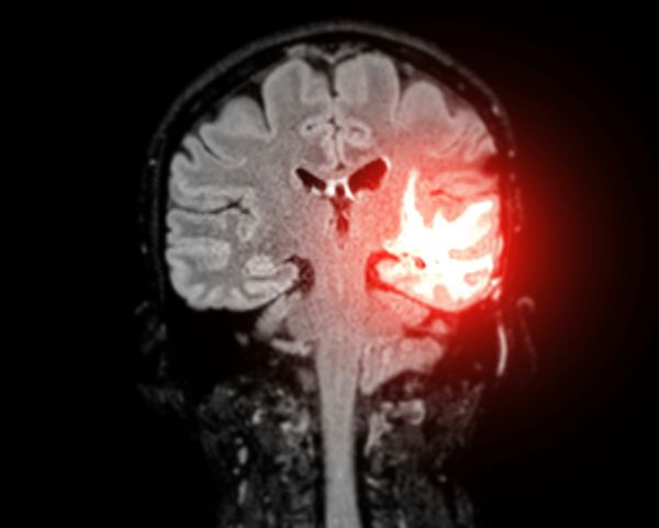 AI 모델 개발을 위한 양질의 데이터가 필요할 때