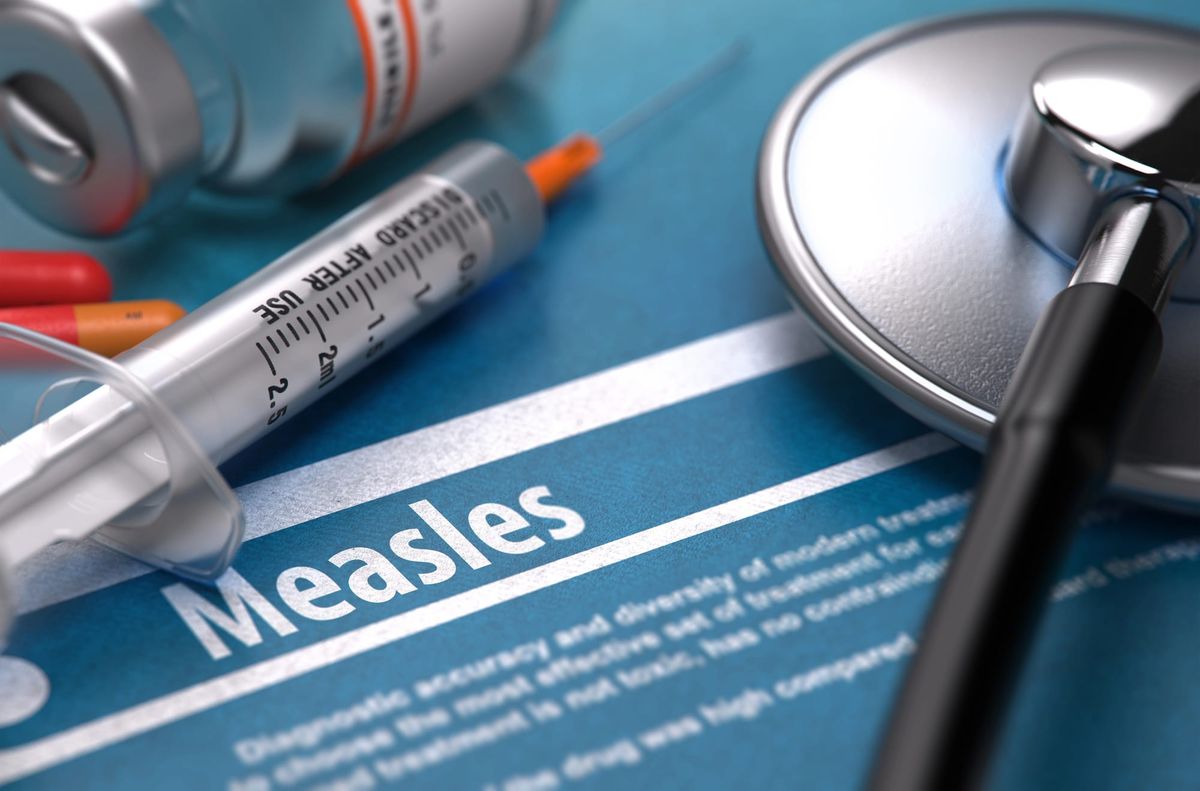 What do we know about the current measles outbreak in the UK?