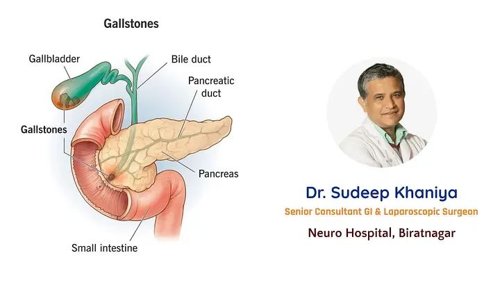 What is Gallstone Disease?