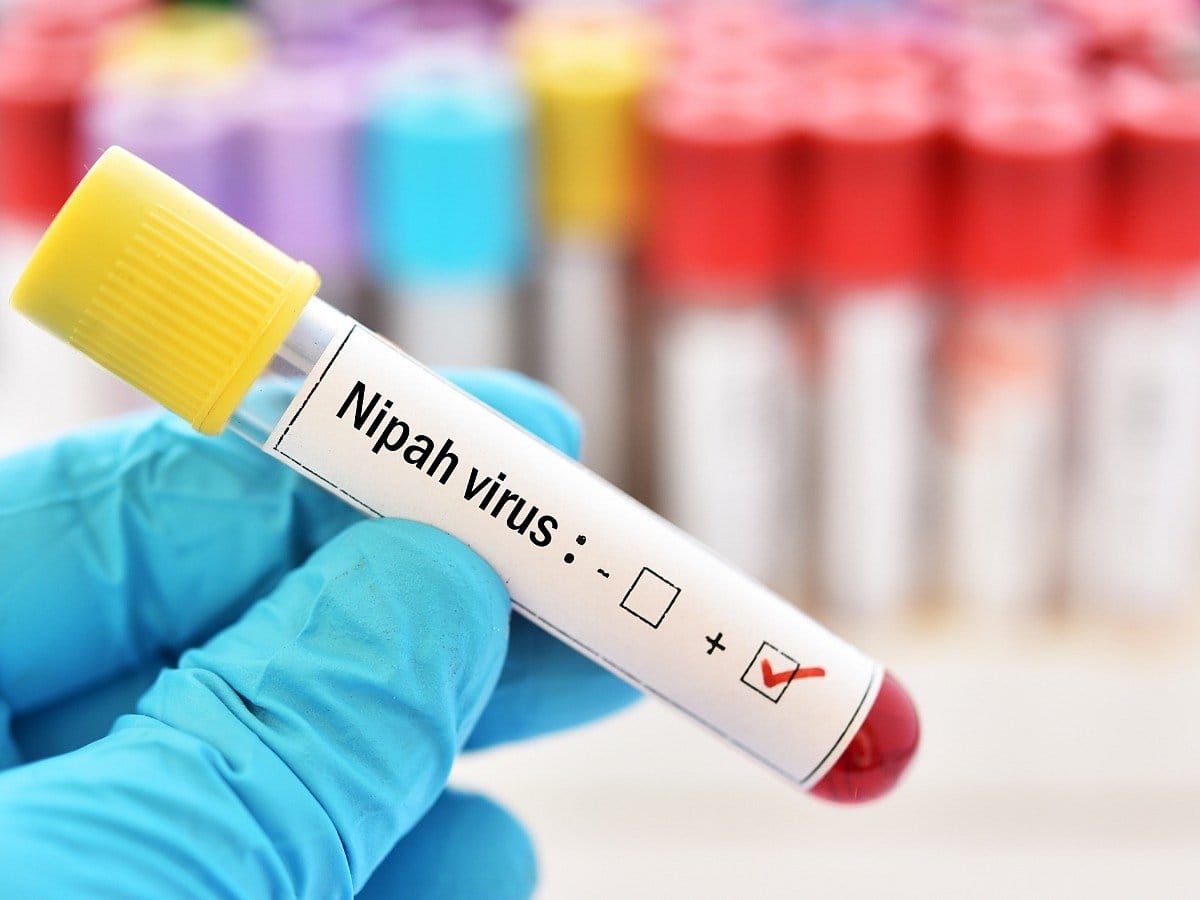 What is Nipah Virus and How to Get Rid of It?