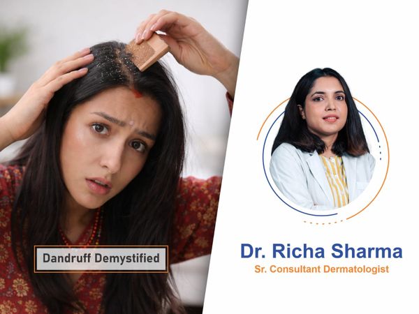 Dandruff Demystified: Causes, Cures, and Why Your Scalp Flakes in Winter