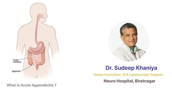 What is Acute Appendicitis ?