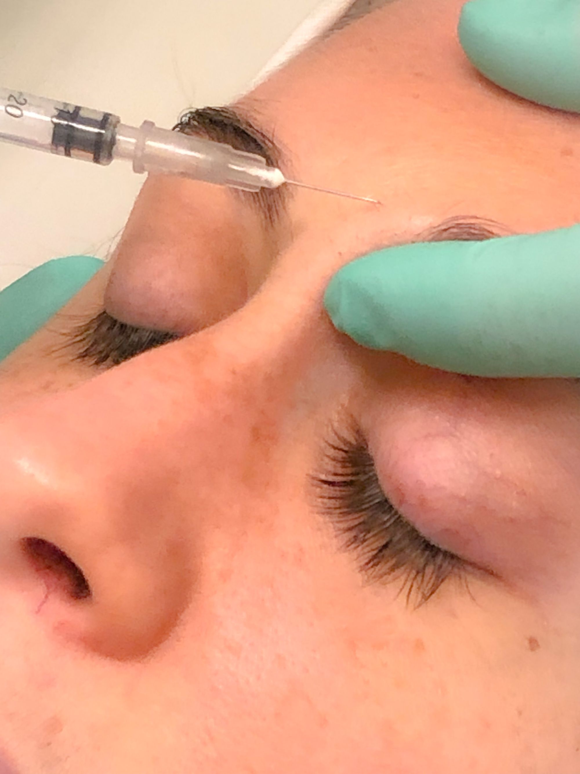 Dra. Karina Koch - Medicina Estética - MN 169365