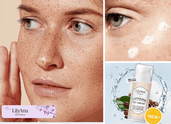 LilyAna Naturals Caffeine Eye Cream: Your Weapon Against Tired Eyes