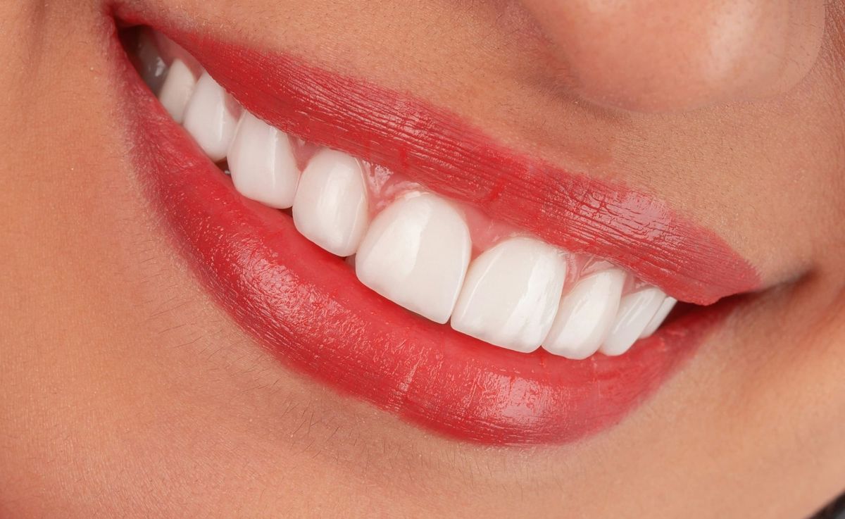 Female showing her teeth representing Align Technology in a stock rallies after earnings beat as broader market declines