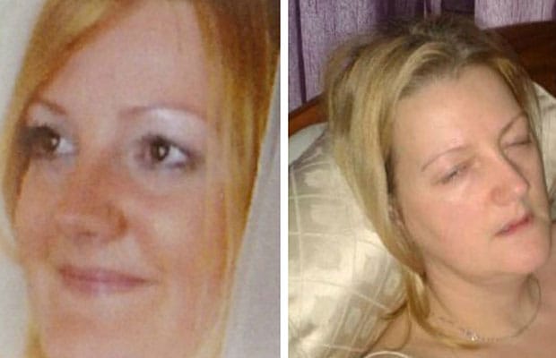 Laura Brown pictured before and after her diagnosis with Lyme disease