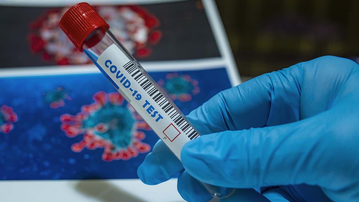 coronavirus test