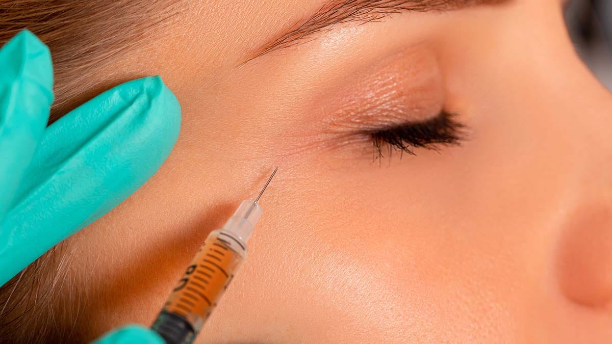 Filler injection. 